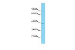 CCDC198 Rabbit anti-Human, Polyclonal, Novus Biologicals 100 &mu;g; Unconjugated:Antibodies,